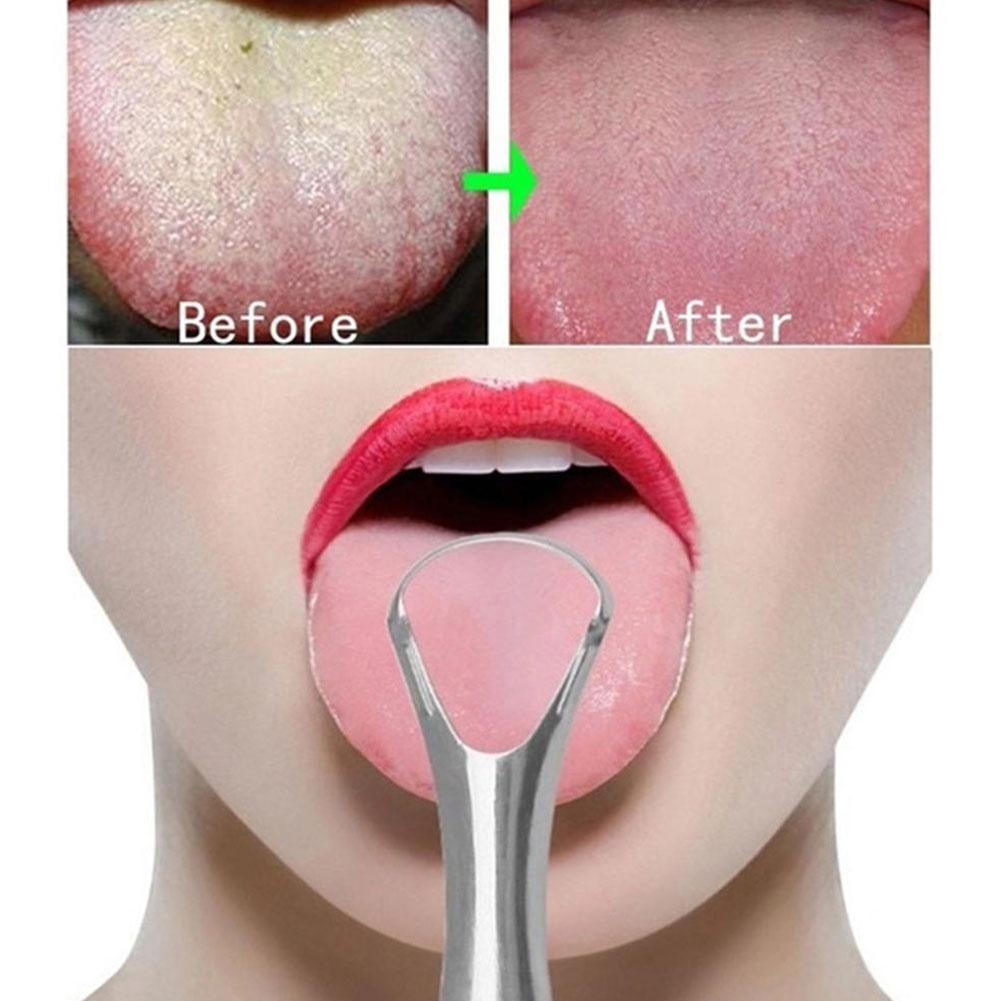 Stainless Steel Tongue Scraper – Reusable Tongue Cleaner for Fresh Breath & Oral Hygiene - WebLuxes Store