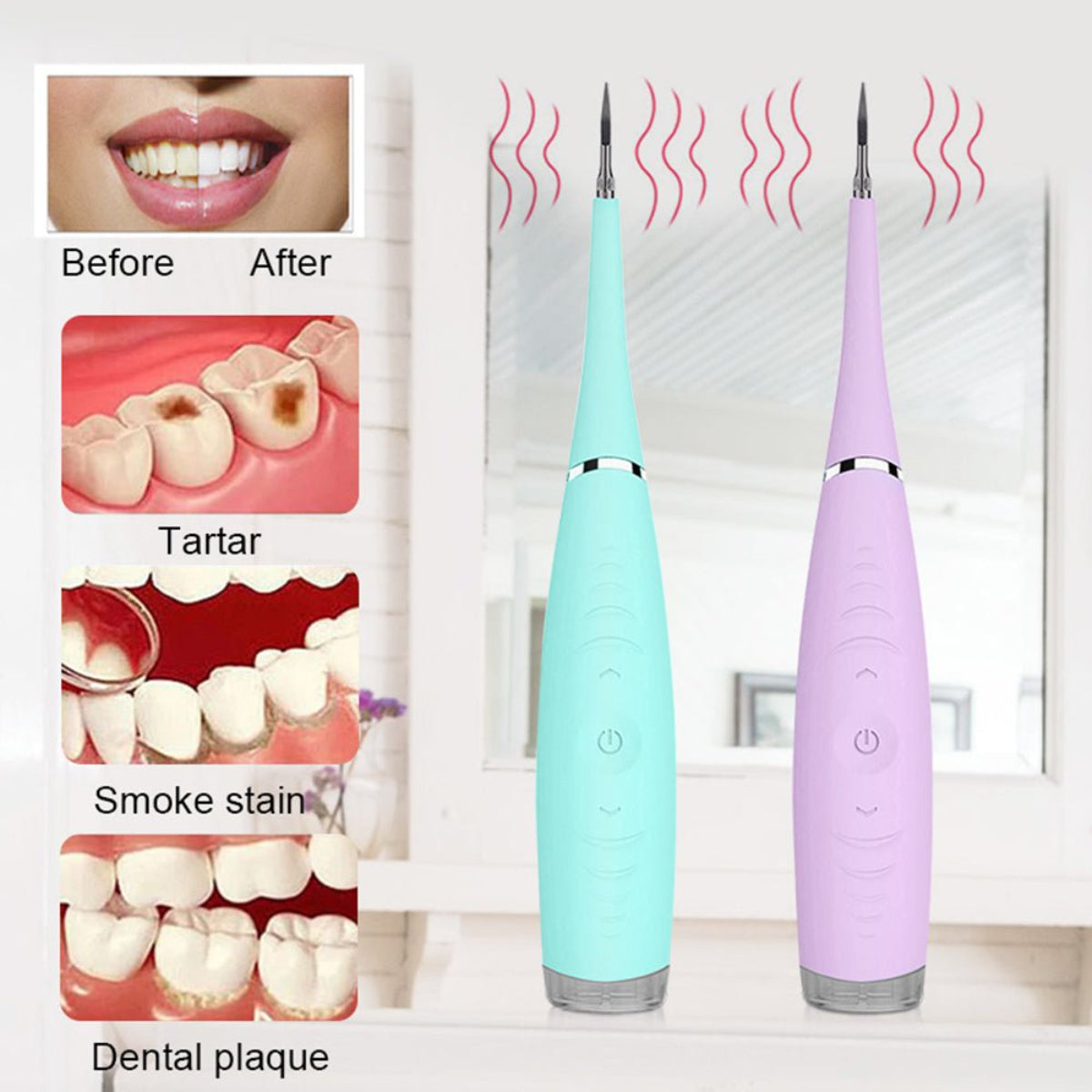 UltraSonic Dental Calculus Remover